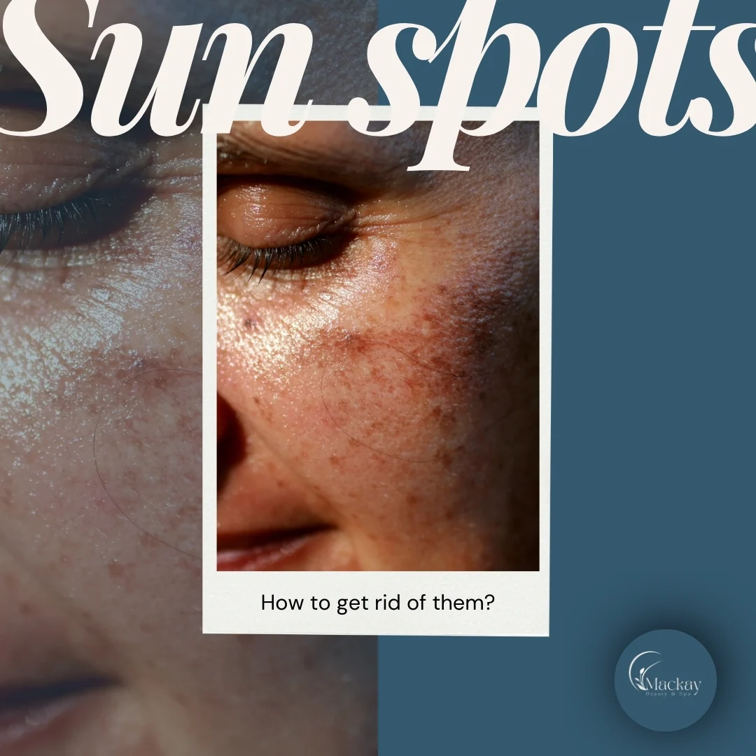 How to Get Rid of Sun Spots: illustration from the practice guide