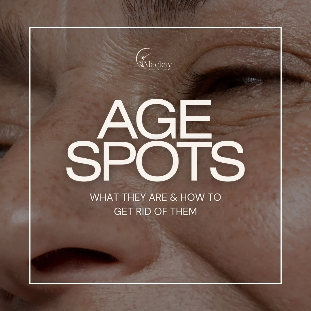 Age Spots Guide: Causes, Prevention & Treatments: illustration from the practice guide