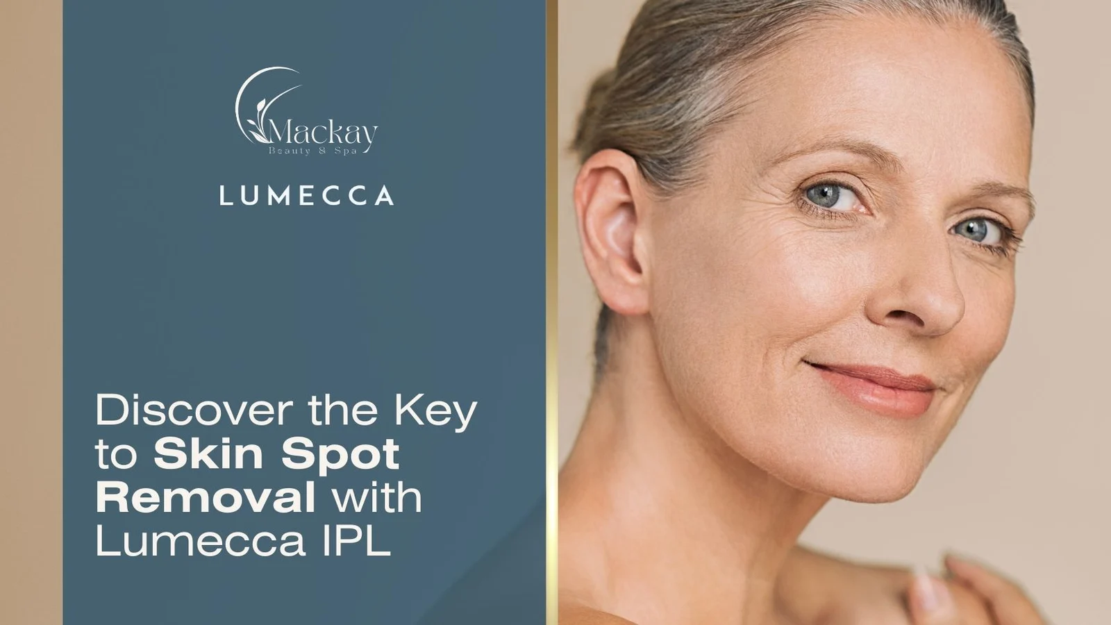 skin spot removal woman Mackay Vein & Aesthetics st pete