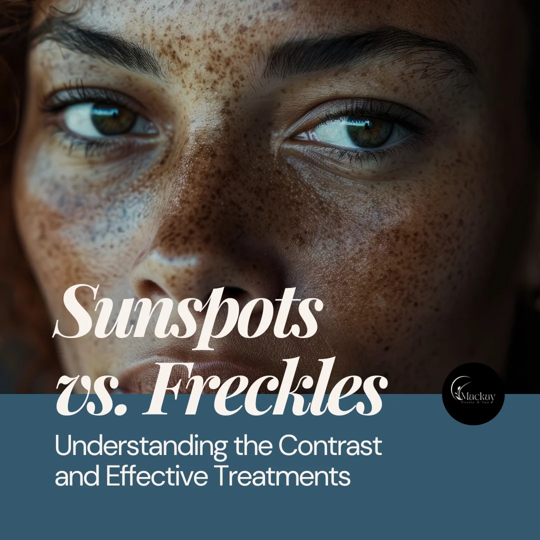 Sun Spots vs Freckles – What is the Difference?: illustration from the practice guide