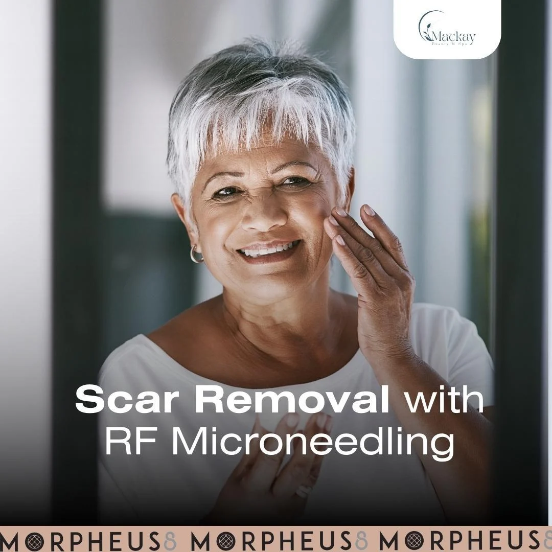 scar removal face woman Mackay Vein & Aesthetics