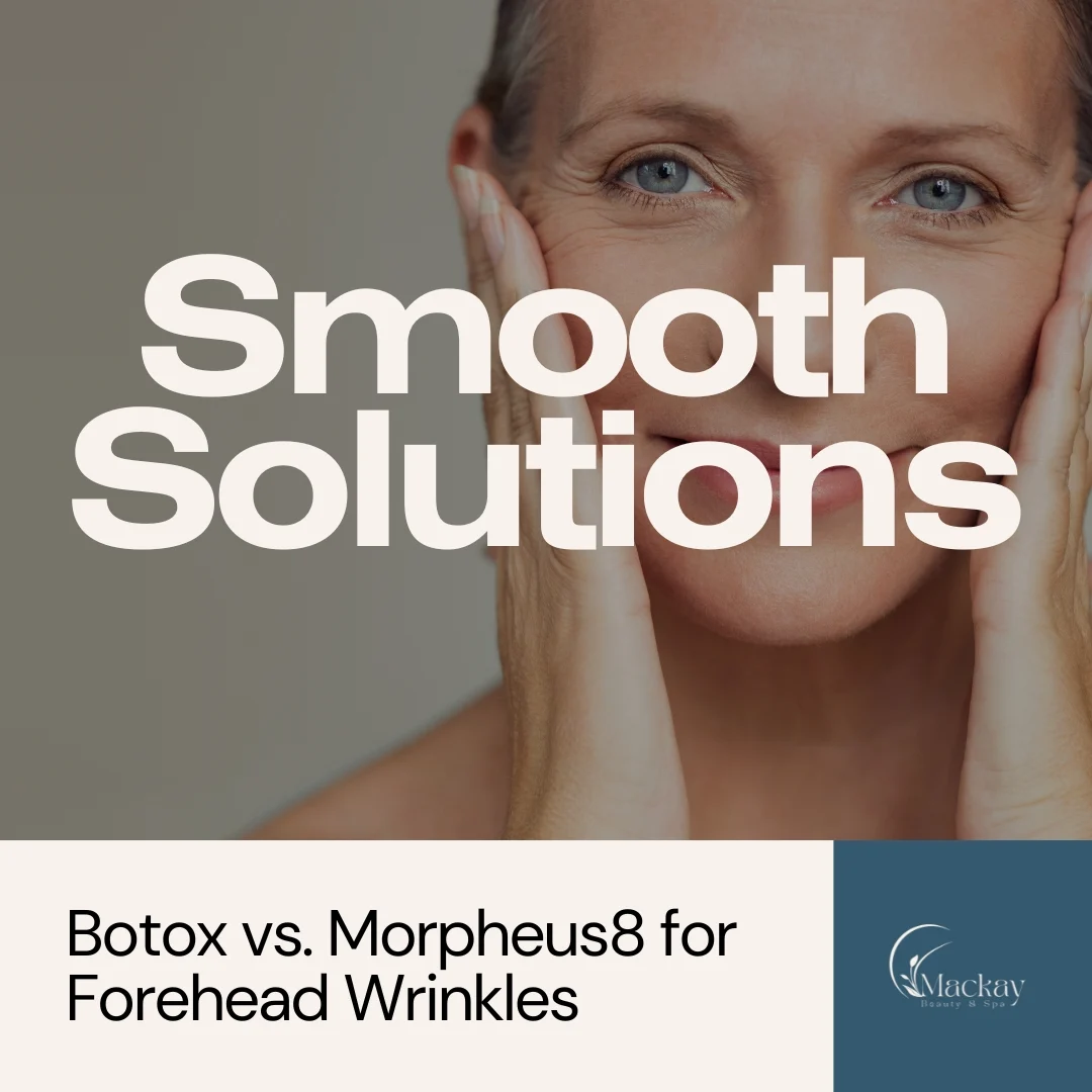 MMS-Smooth-Solutions-
