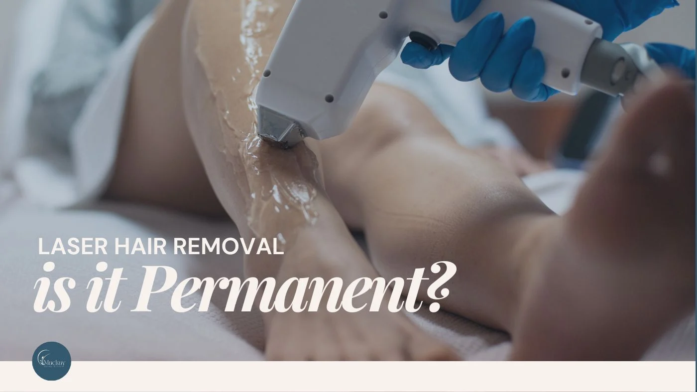 How Long Does Laser Hair Removal Last?