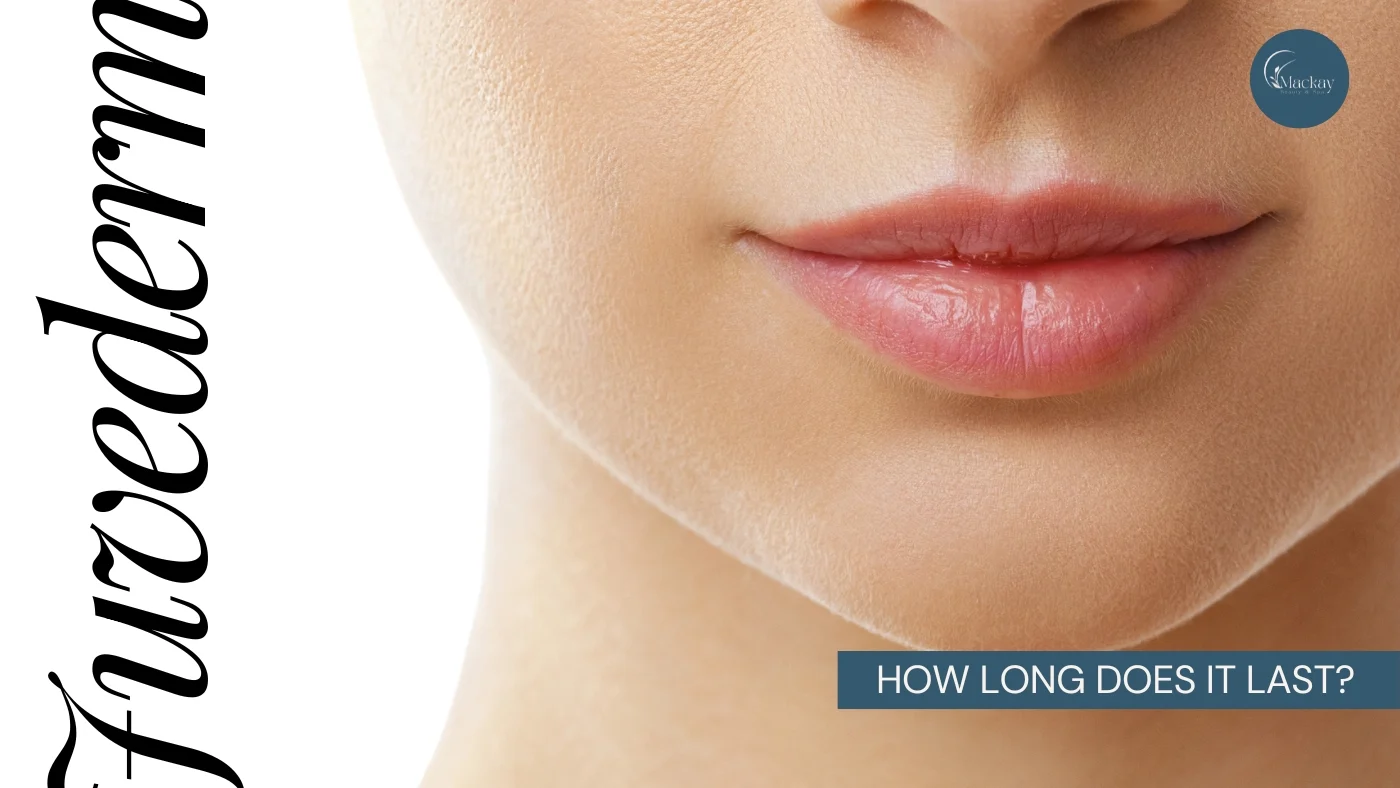 How Long Does Juvederm Last?