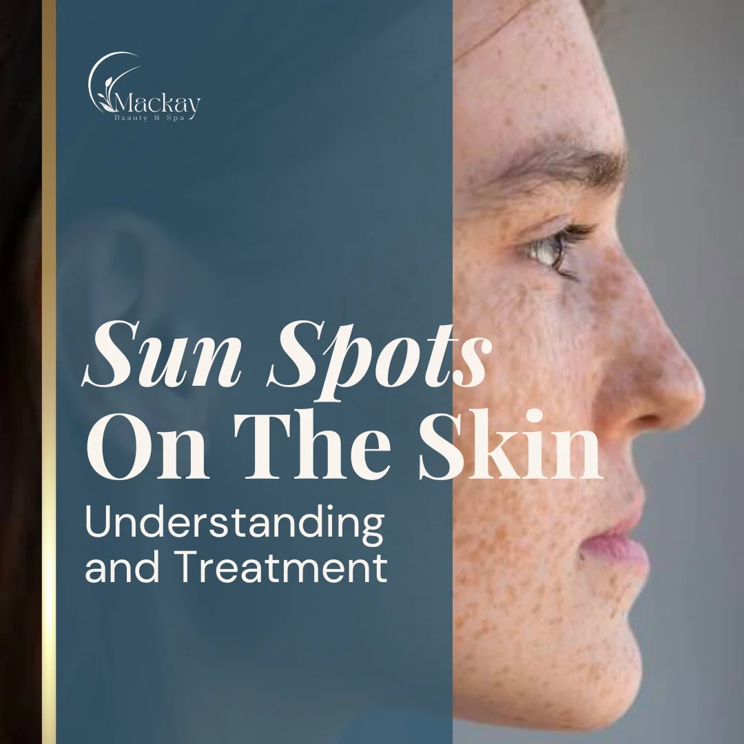 Sun Spots On The Skin: illustration from the practice guide