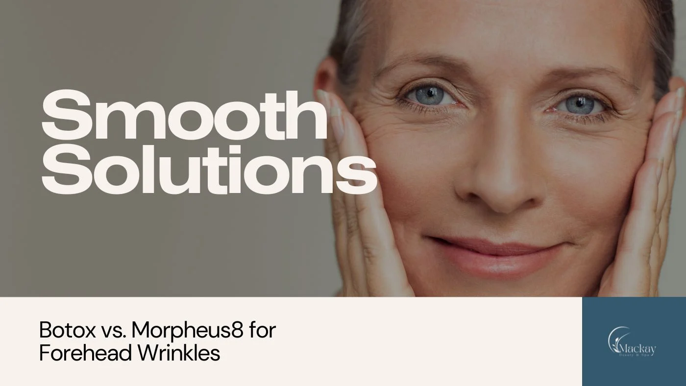 MMS-Smooth-Solutions-