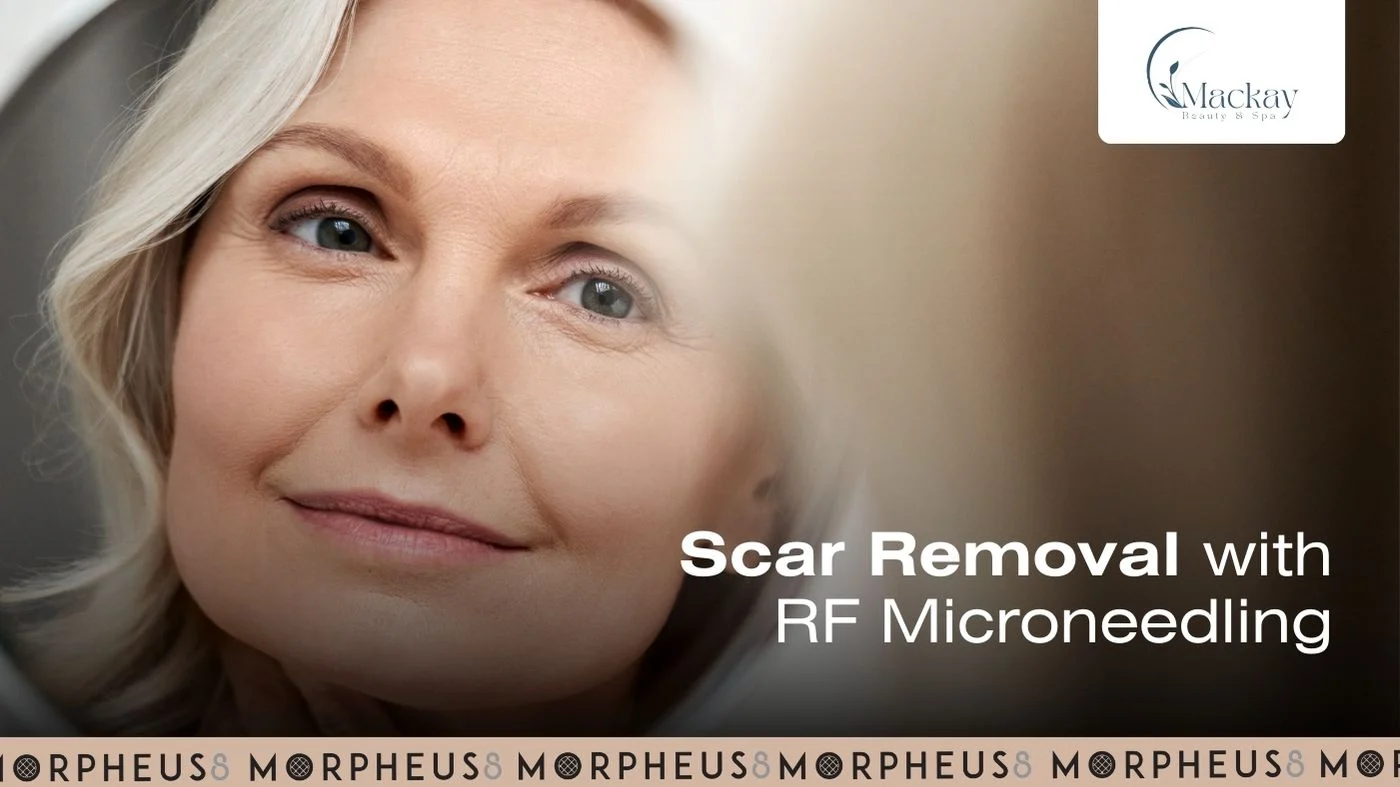 scar removal microneedling st pete