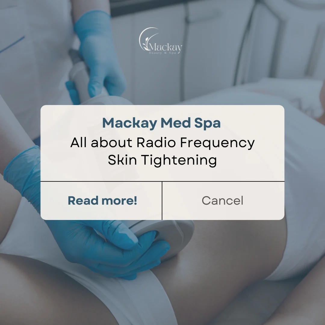 Radio Frequency Skin Tightening: illustration from the practice guide