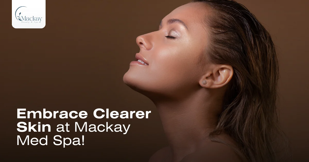 Acne Scar Removal in St. Pete