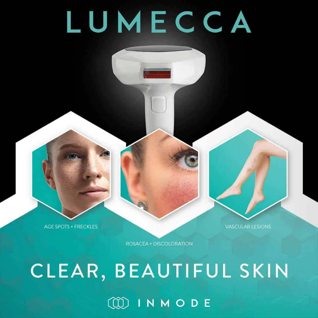 Lumecca IPL: illustration from the practice guide