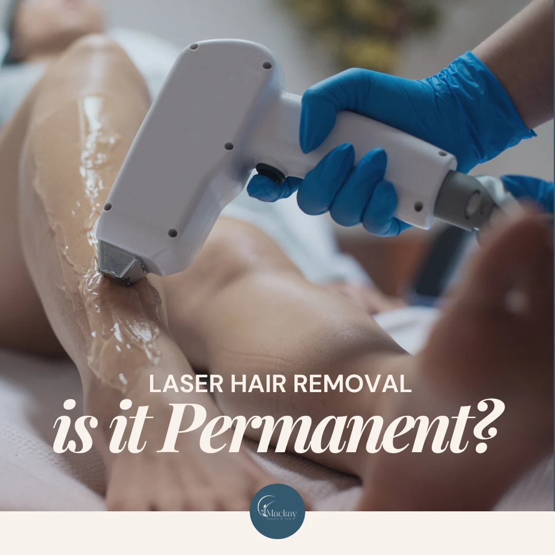 How Long Does Laser Hair Removal Last?: illustration from the practice guide