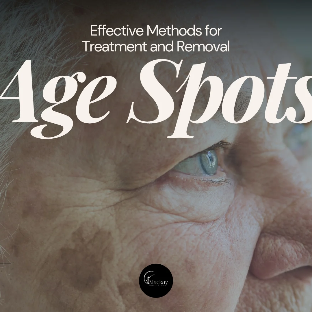 How to Get Rid of Age Spots: illustration from the practice guide