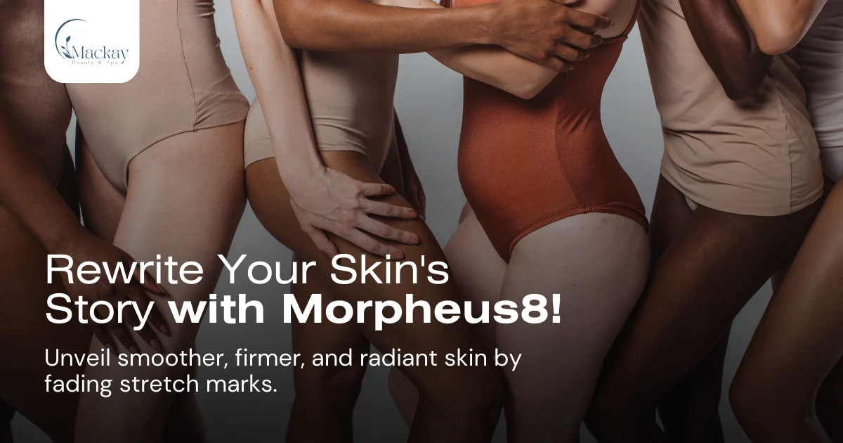 stretch mark removal morpheus8 leg lineup
