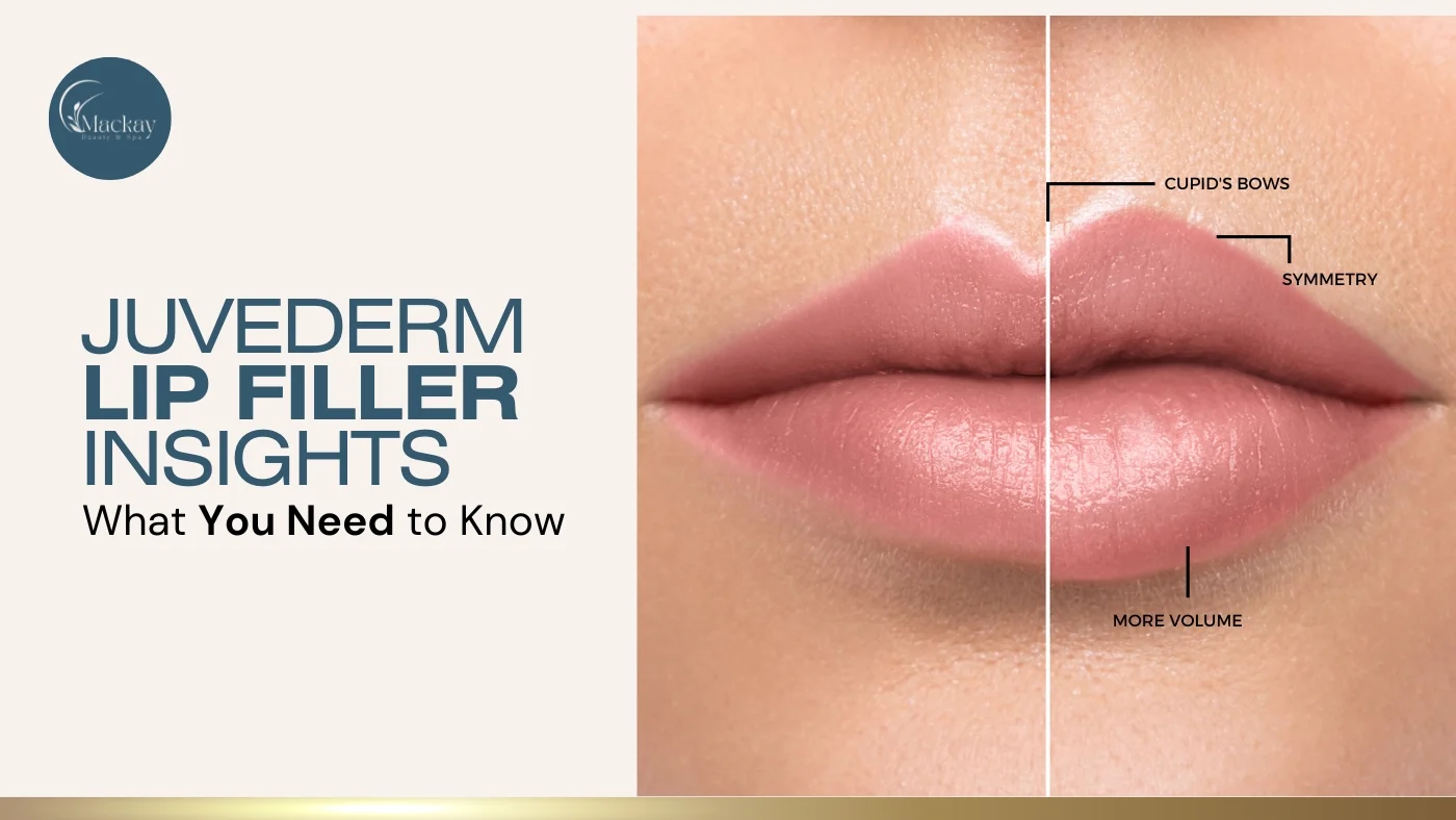What You Should Know About Juvederm Lip Filler