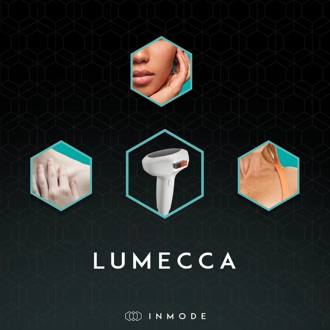 Lumecca IPL: illustration from the practice guide