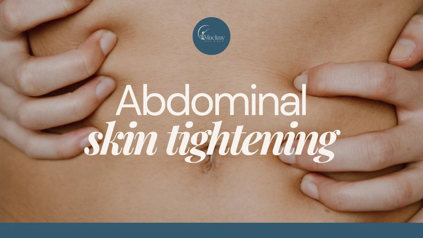 Skin Tightening on the Stomach