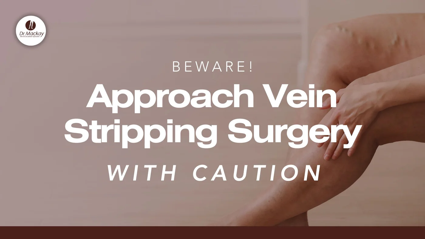 Approach Vein Stripping Surgery - Blog with dr edward mackay