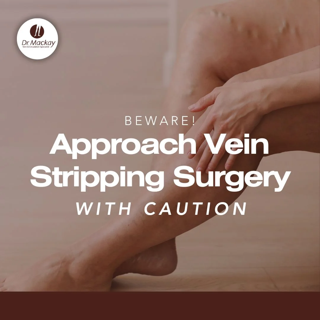 Approach Vein Stripping Surgery - IG with dr edward mackay