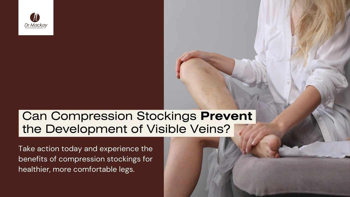 Do Compression Stockings Prevent Varicose and/or Spider Veins?