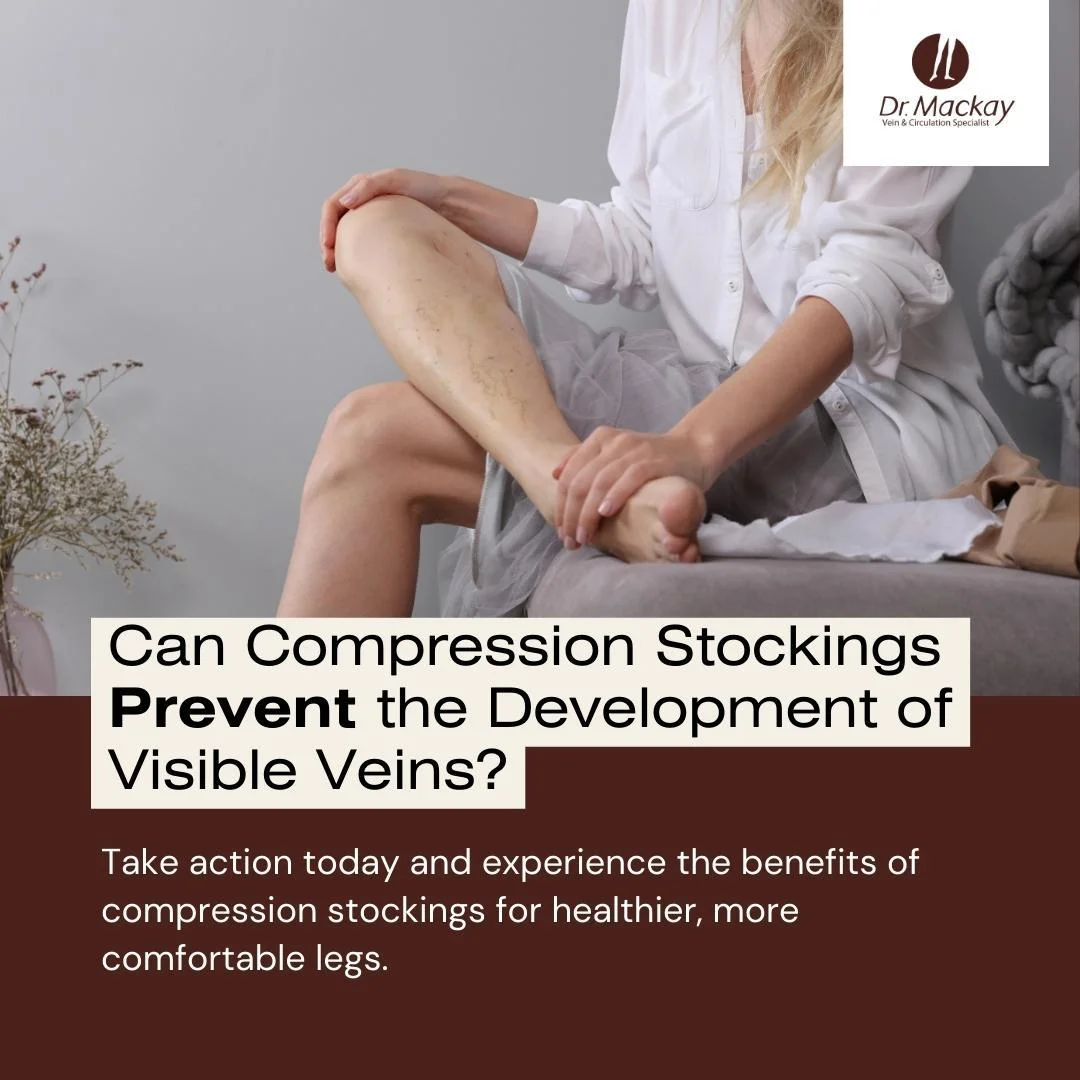 Can_Compression_Stockings_Prevent_the_Development_of_Visible_Veins