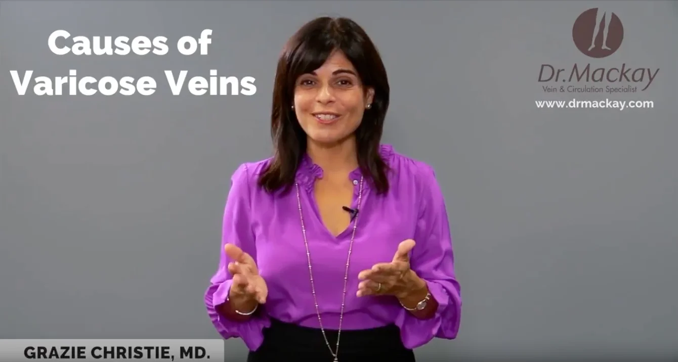 What Causes Varicose Veins?