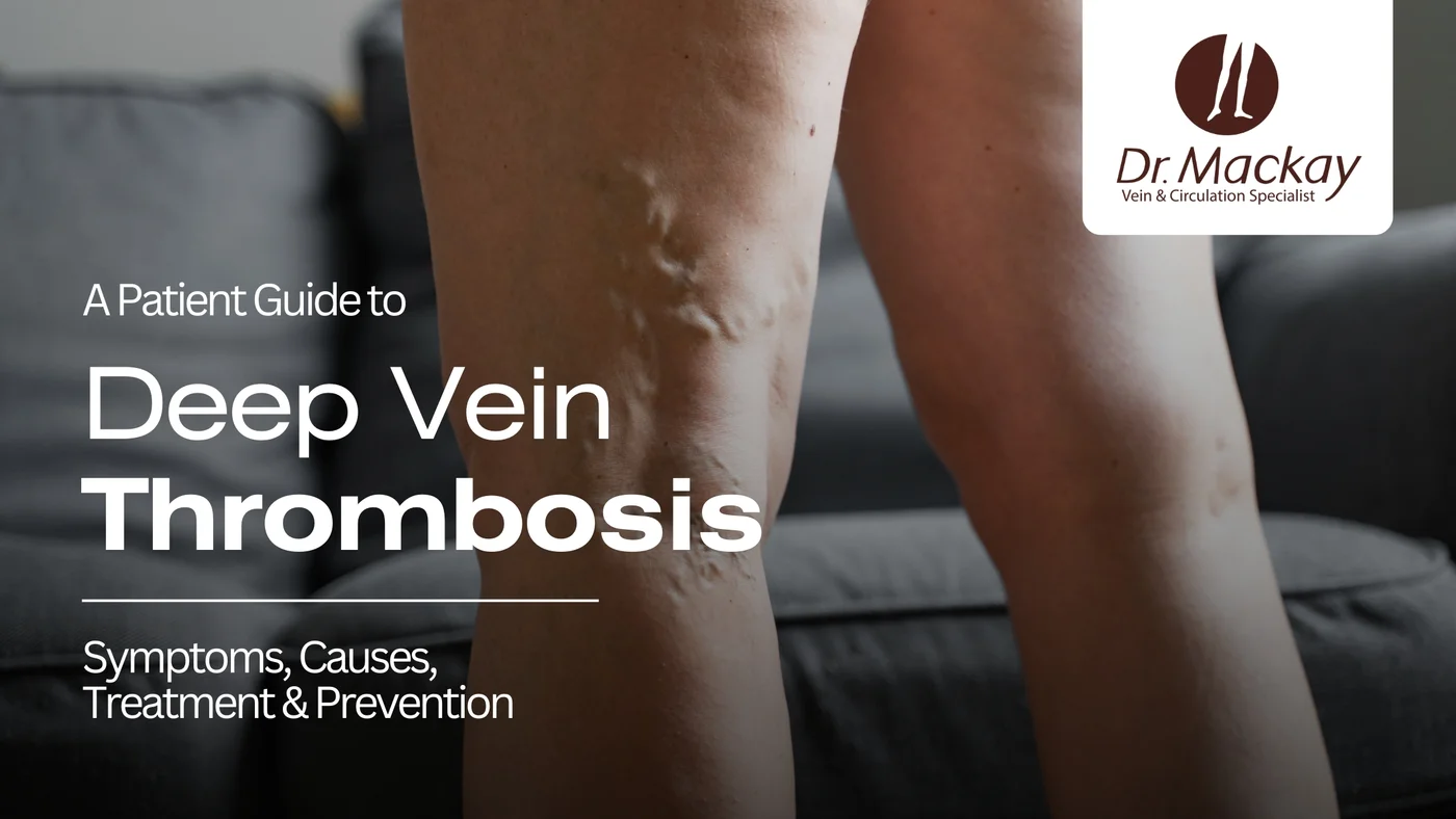 Deep Vein thrombosis surgery patient guide symptoms causes treatments prevention banner