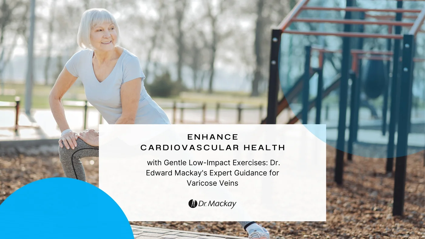 Can Varicose Veins Disappear with Exercise?
