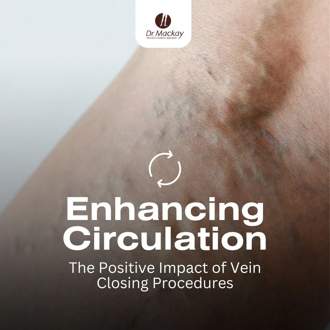 enhancing vein circulation banner vert