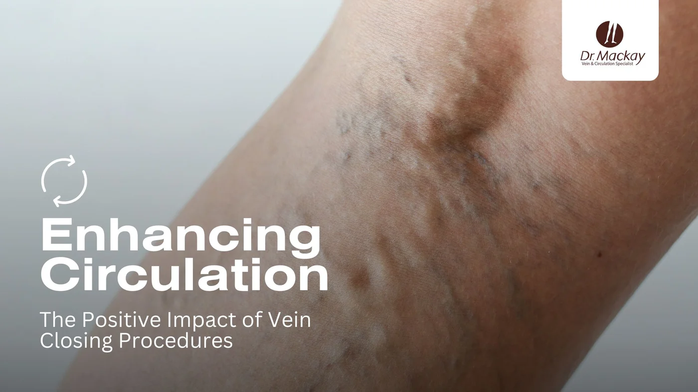 vein circulation enhancements banner