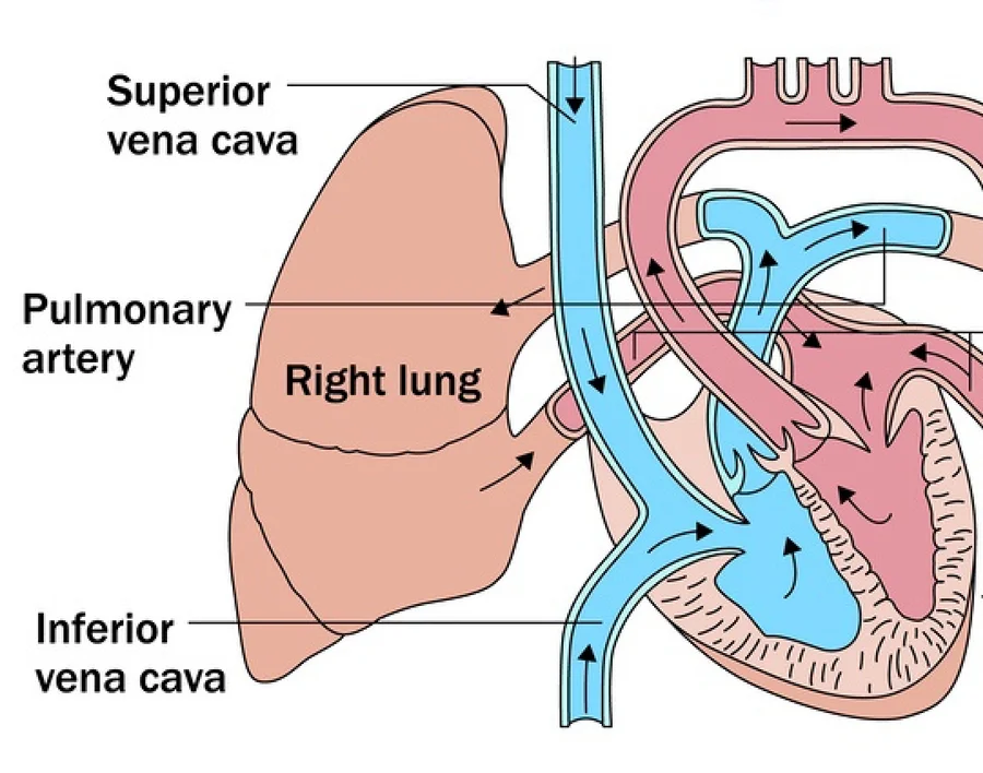inferior vena cava circulation diagram