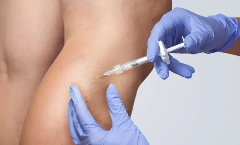 Spider Vein Treatment Solutions