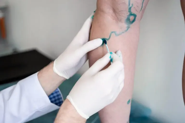 How Can a Vascular Surgeon Help Me?