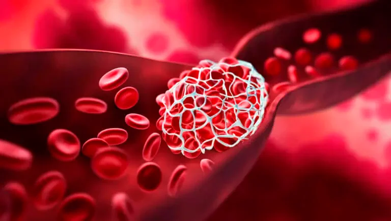 Drugs Used for Vein Blockage Treatments