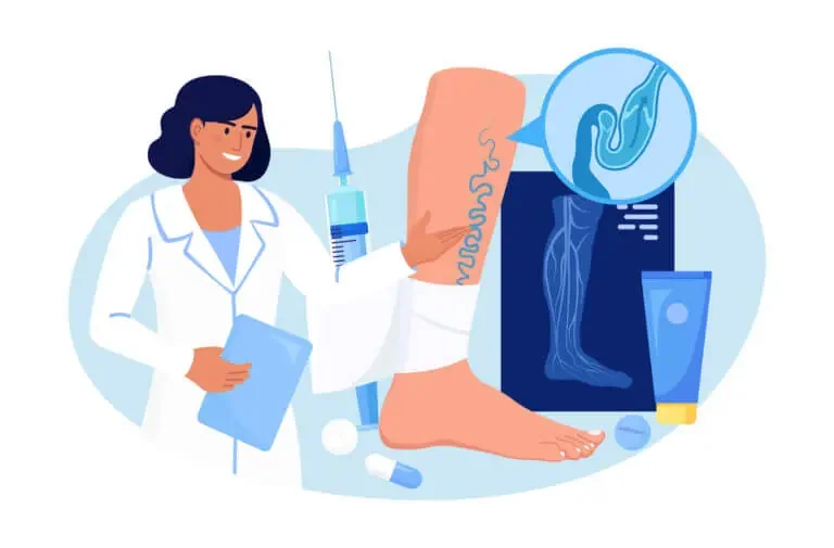 Questions to Ask a Vein Surgeon
