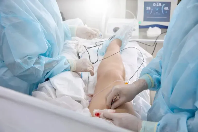 The Procedure Details for Vein Ablation