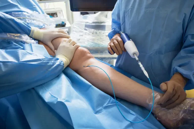 What to Know Before Getting Vein Surgery