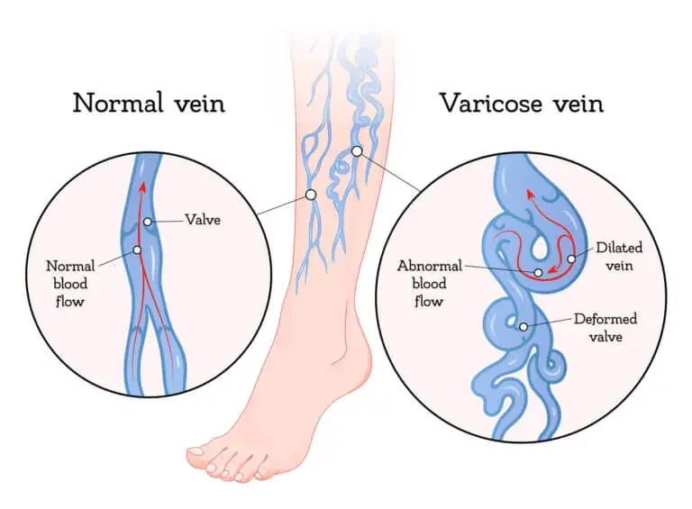 What a Vascular Surgeon Does: Far More Than Surgery