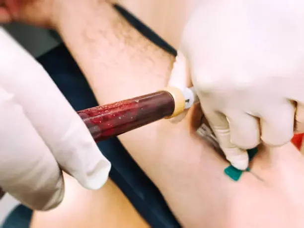 How to Choose a Vein Ablation Practitioner