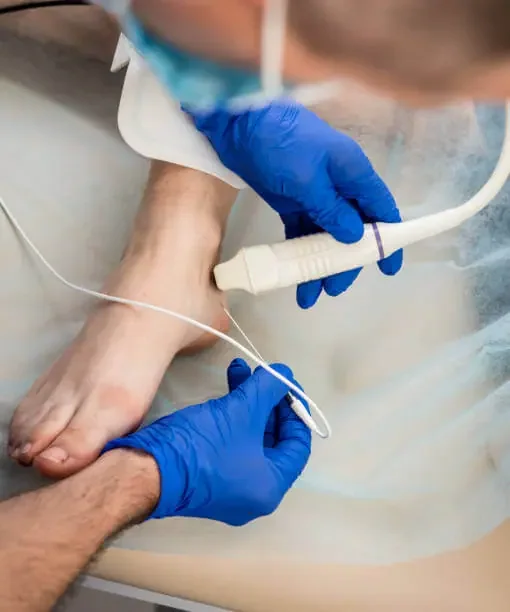 Proven Painless Ways to Treat Veins