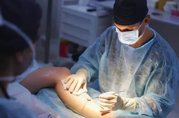 What to Expect: Recovery from Vein Surgery on Legs