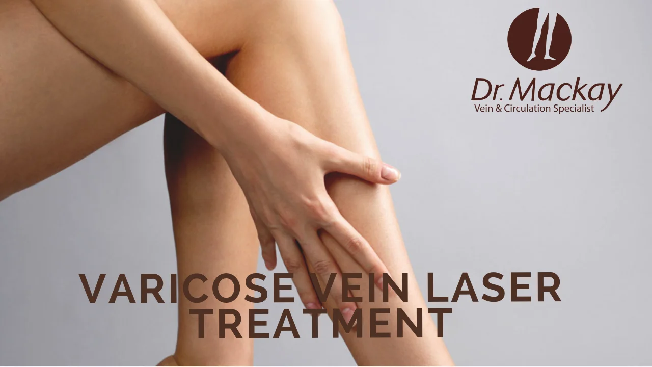 Laser Treatment for Varicose Veins