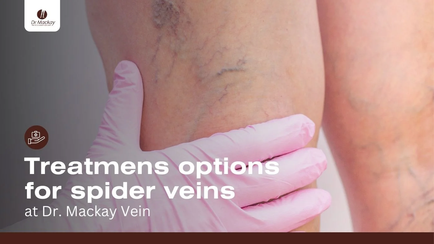 spider vein treatments blog banner dr mackay