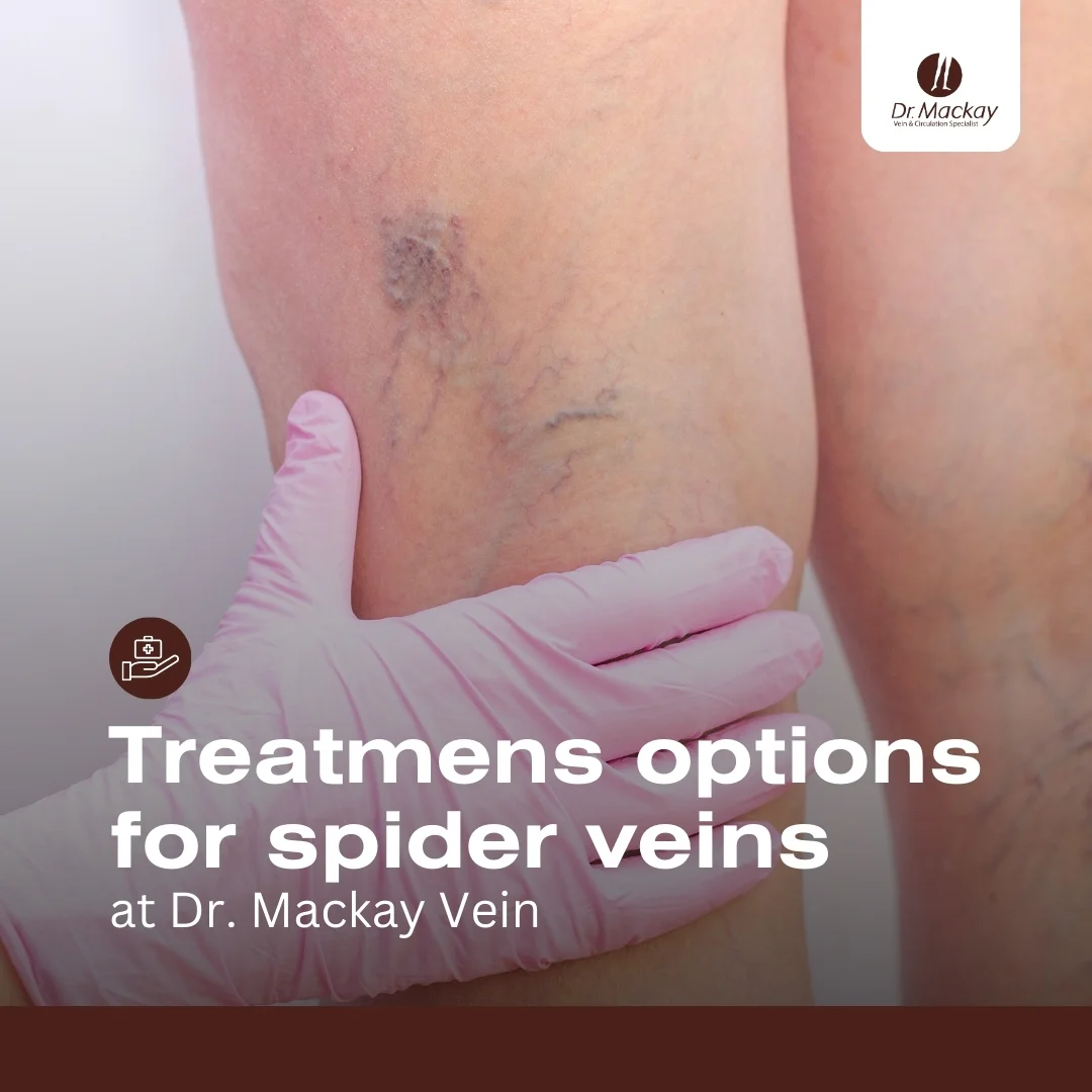 MAC_-_2_Spider_vein_treatments_-_IG