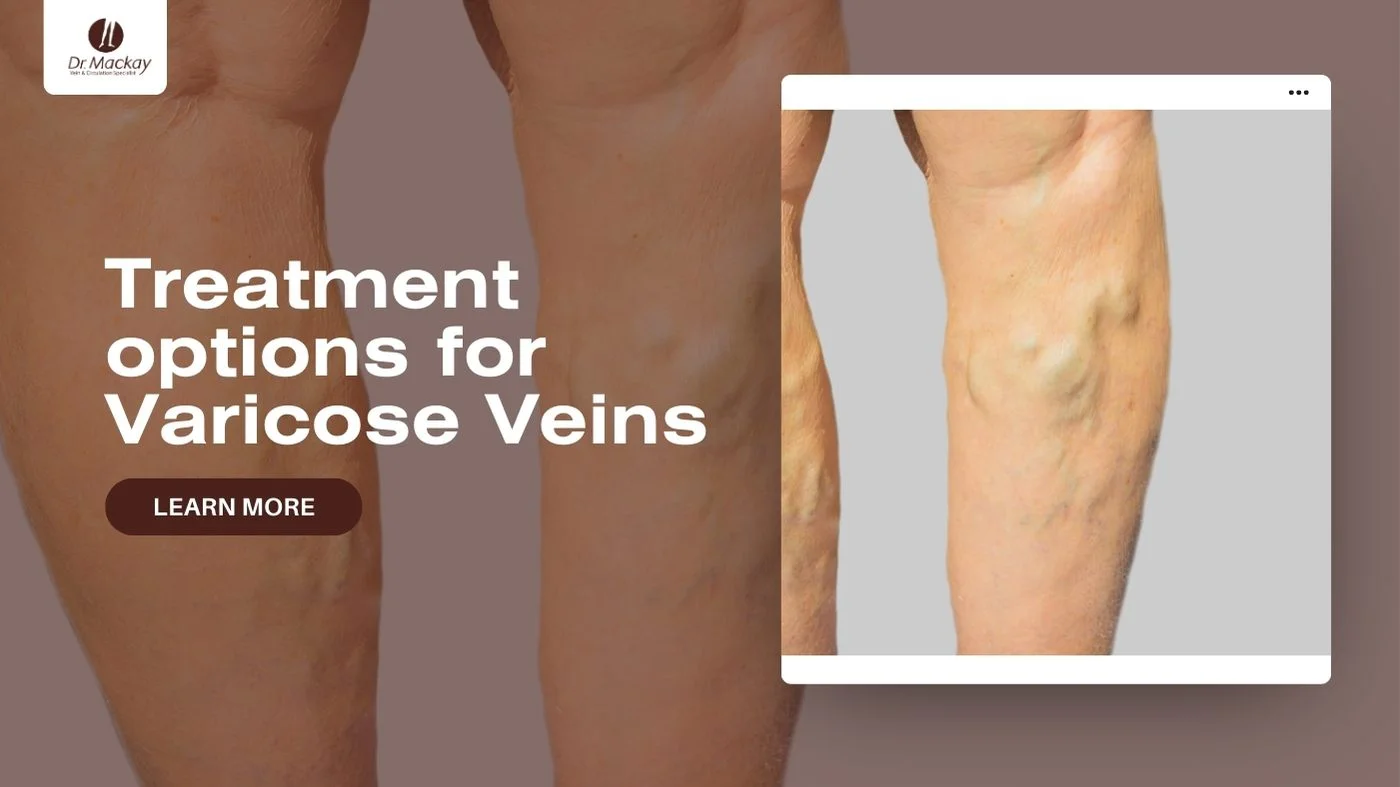 Varicose Vein Treatments at Dr. Mackay Vein Clinic