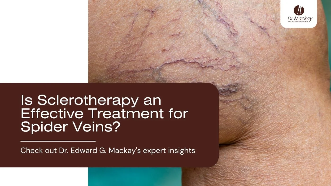 Spider Veins Removal in Pinellas with Dr. Mackay blog banner 2
