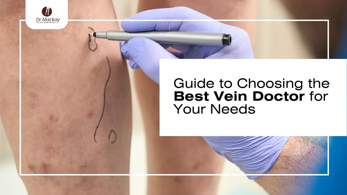 Vein Doctor Guide. What type do you need?