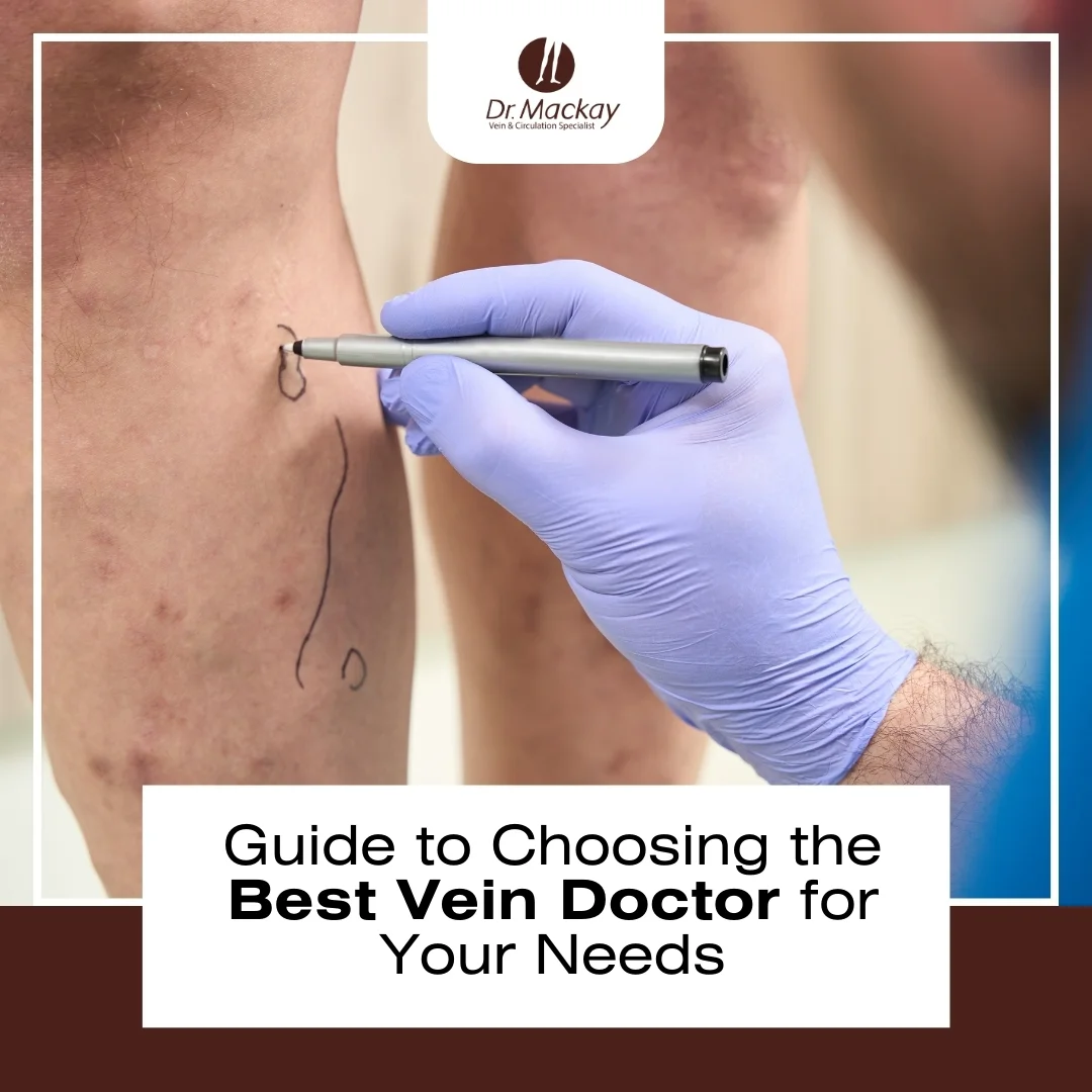 MAC - Guide to Choosing Vein Doctor - IG
