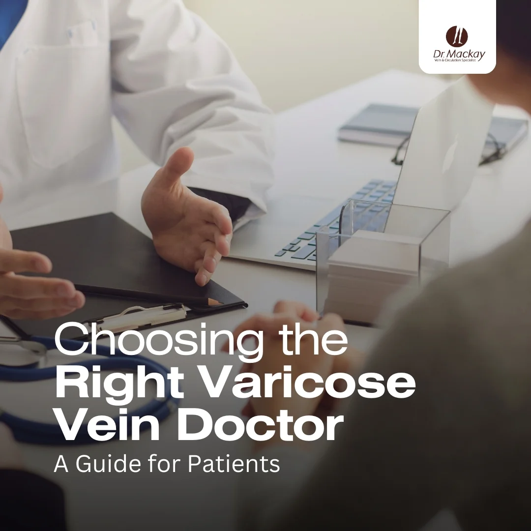 MAC - How to select a varicose vein doctor - IG