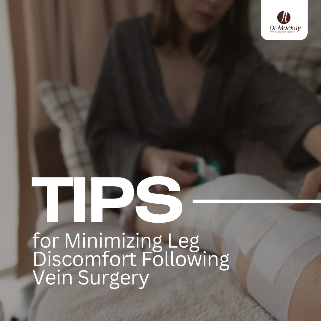 MAC - Tips to prevent or reduce leg pain after vein surgery - IG