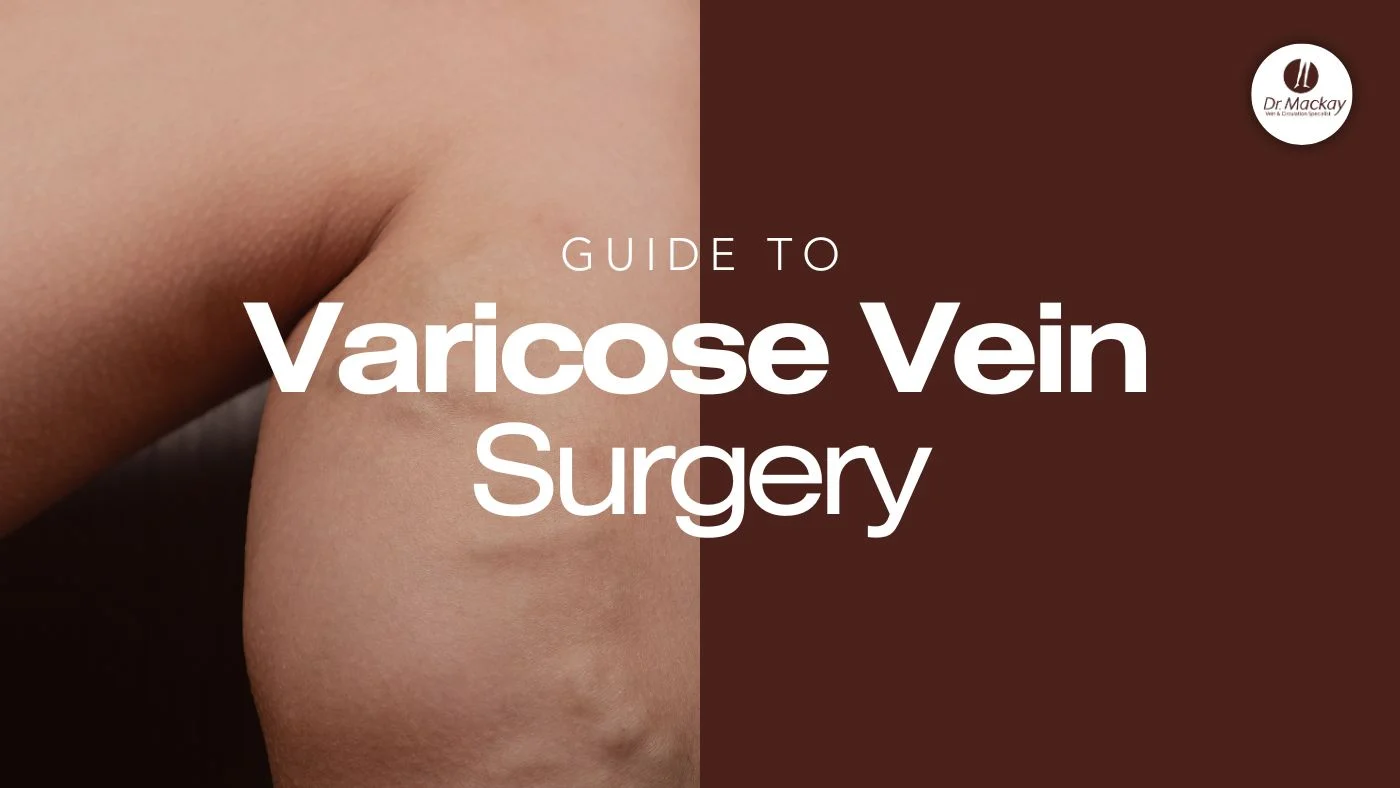 Varicose Vein Surgery Treatment Options